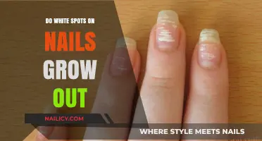 White Spots on Nails: Do They Grow Out?