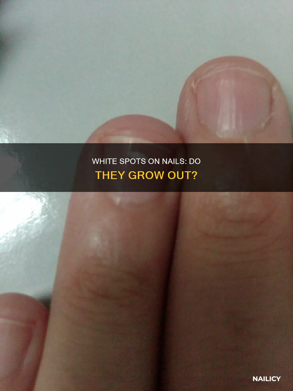 do white spots on nails grow out
