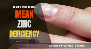 White Spots on Nails: Are They a Sign of Zinc Deficiency?