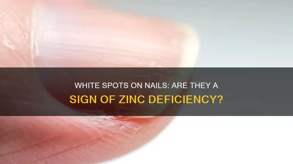 do white spots on nails mean zinc deficiency