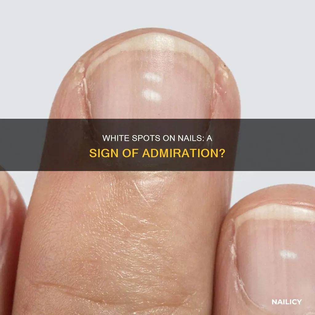 do white spots on your nails mean someone likes you