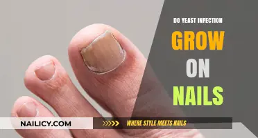 Yeast Infections: Can They Grow on Nails?