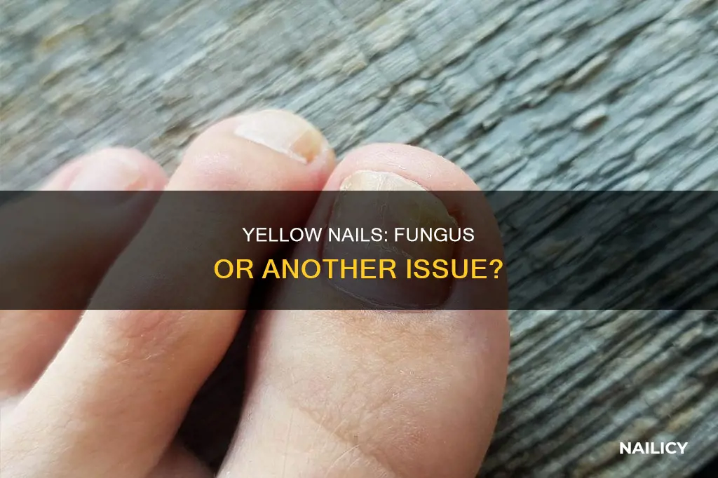 do yellow nails always mean fungus