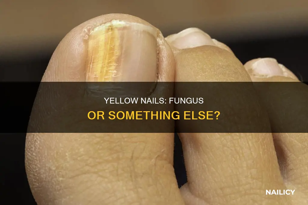 do yellow nails always mean fungus