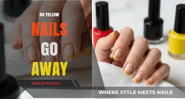 How to Treat and Prevent Yellow Nails: A Complete Guide