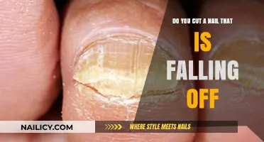 How to Treat a Falling Nail: To Cut or Not?