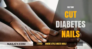 Diabetics' Nail Care: Cutting and Trimming