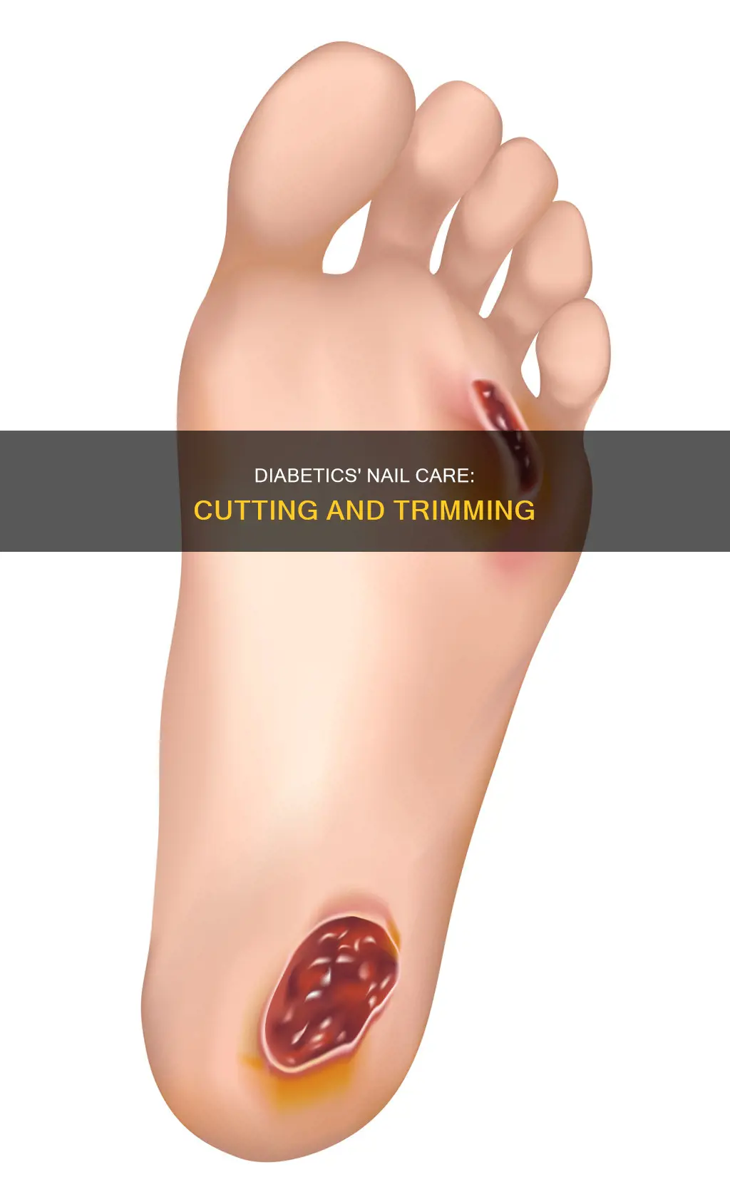 do you cut diabetes nails