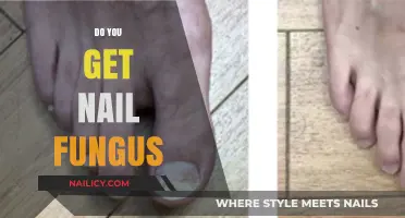 Understanding Nail Fungus: Causes, Symptoms, and Effective Treatments