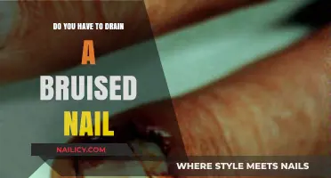 Should You Drain a Bruised Nail? Expert Tips and Advice