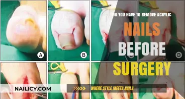 Acrylic Nails: Safe or Not Before Surgery?