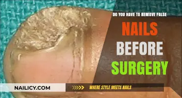 False Nails: Pre-Surgery Removal Necessity?
