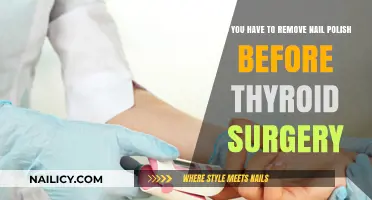 Thyroid Surgery: Should You Remove Nail Polish?