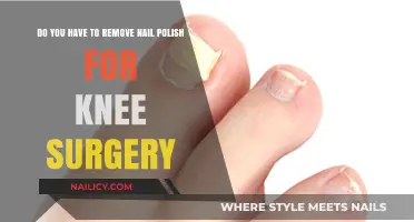 Is Nail Polish Removal Necessary for Knee Surgery?