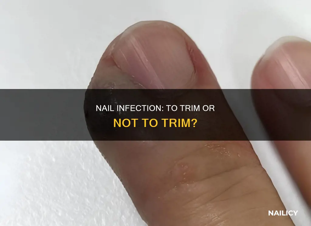 do you lance an infected finger along the nail