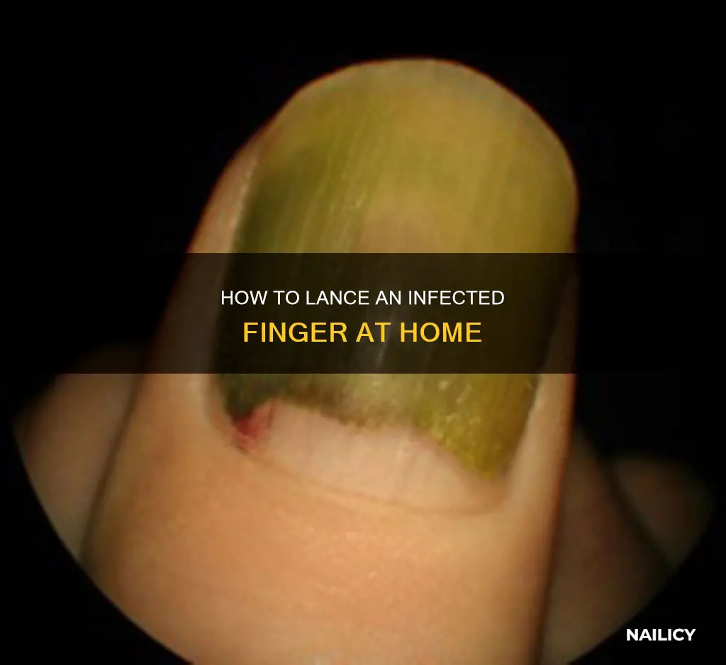do you lance an infected finger along the nail