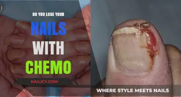 Chemotherapy and Nail Health: What to Expect During Treatment