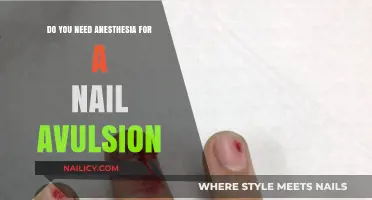 Nail Avulsion Procedure: Anesthesia Required or Not? Expert Insights