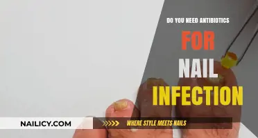 Antibiotics for Nail Infections: Are They Necessary or Overused?