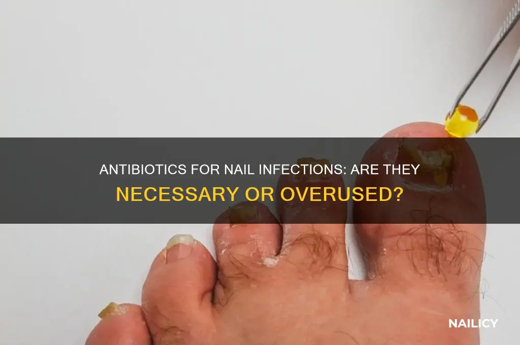 do you need antibiotics for nail infection