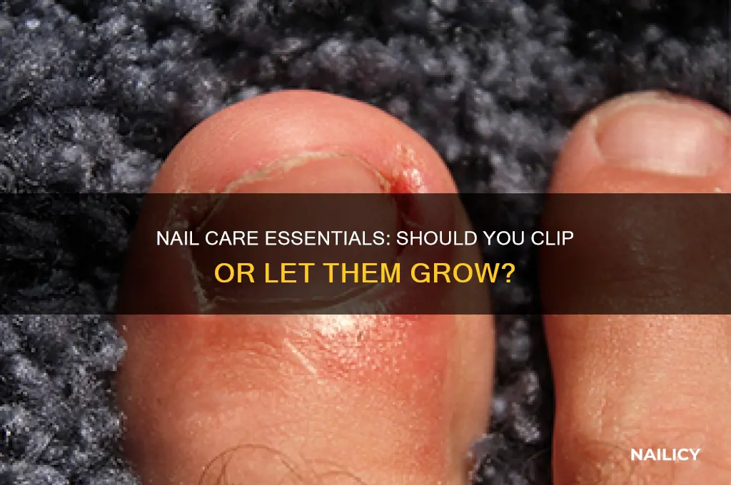 do you need to clip your nails
