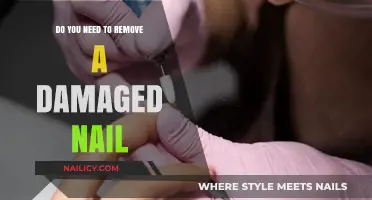 Damaged Nail Removal: When and How to Do It