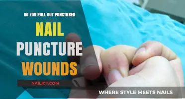 Should You Remove Punctured Nails from Puncture Wound Injuries?