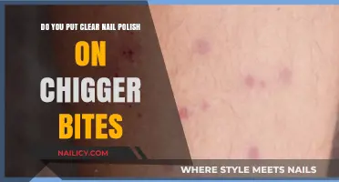 Clear Nail Polish for Chigger Bites: Does It Really Work?