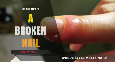 Broken Nail Emergency: To Rip or Not to Rip?