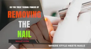 Effective Toenail Fungus Treatment: Removing the Nail