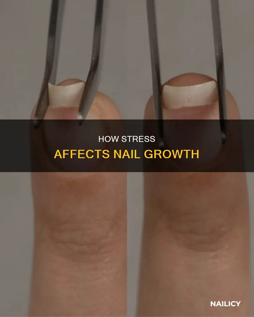 do your nails grow after a stressful event