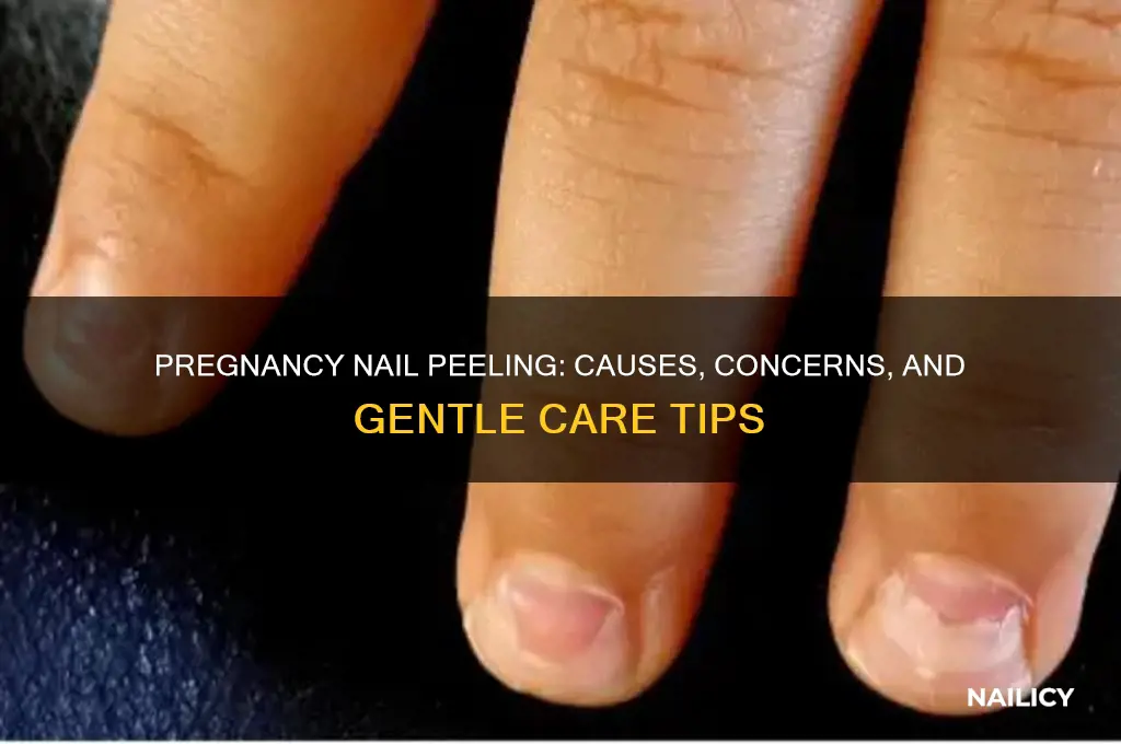 do your nails peel when you are pregnant