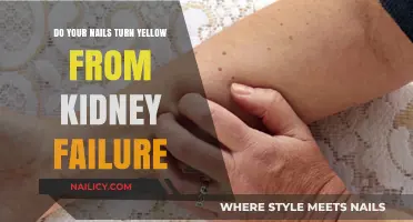 Yellow Nails and Kidney Health: Uncovering the Surprising Connection