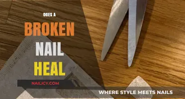 Can Broken Nails Heal? Understanding Nail Repair and Recovery