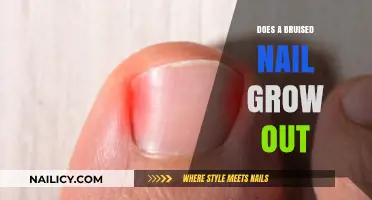 How Bruised Nails Heal: Growing Out Process