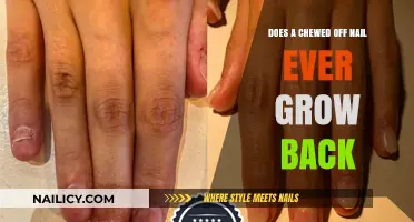 Chewed Nails: Can They Ever Grow Back?