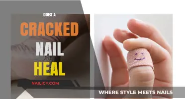 Can Cracked Nails Heal? Understanding Nail Repair and Recovery