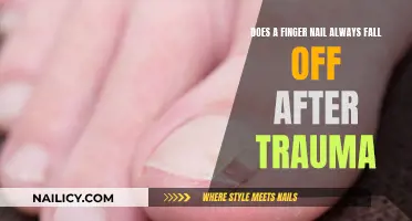 Trauma-Induced Fingernail Loss: Is It Always Inevitable?