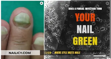 Can a Fungal Infection Cause Green Nails? Facts and Insights
