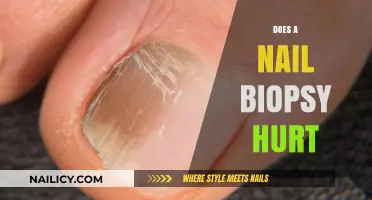 Does a Nail Biopsy Hurt? Pain Expectations and Recovery Tips