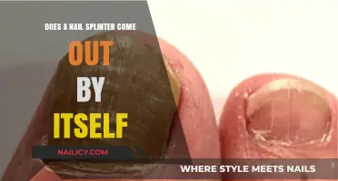 Will a Nail Splinter Exit on Its Own? Understanding Natural Healing