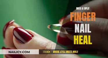 Split Nail: Healing Process and Prevention Tips