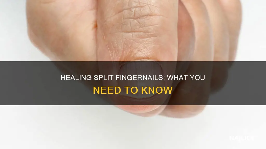 does a split finger nail heal