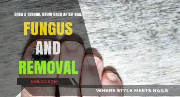 Toenail Fungus: Will Nails Grow Back?