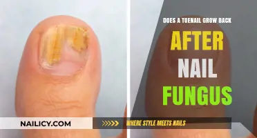 Toenail Fungus: Will Nails Grow Back?