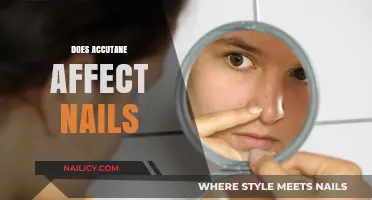 Accutane and Nail Health: Effects, Side Effects, and Care Tips