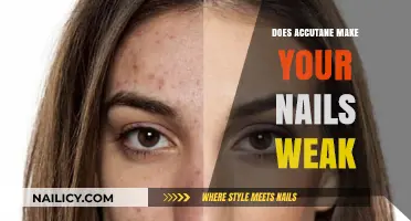 Accutane's Impact: Weak Nails and Their Causes