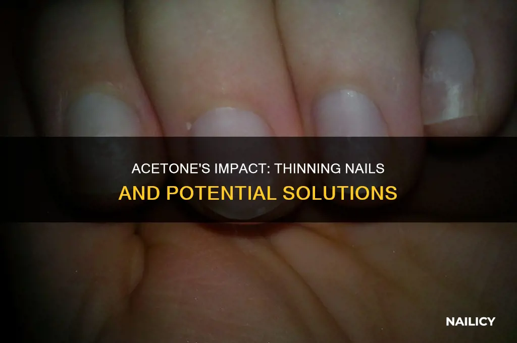 does acetone make your nails thin