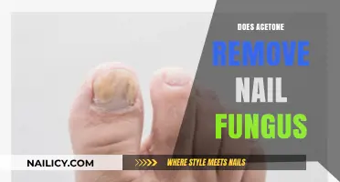 Acetone's Power: Nail Fungus Removal