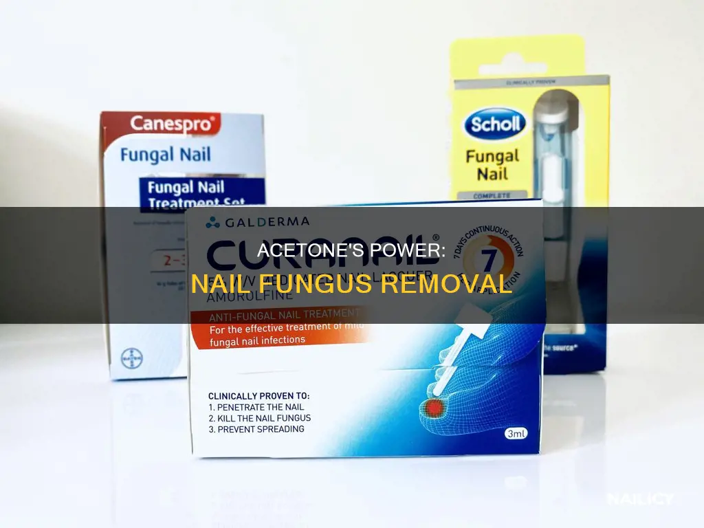 does acetone remove nail fungus